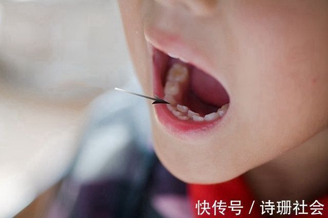 牙胚|孩子长出“双排牙”太难看?是乳牙脱落太晚导致的,需要适当刺激