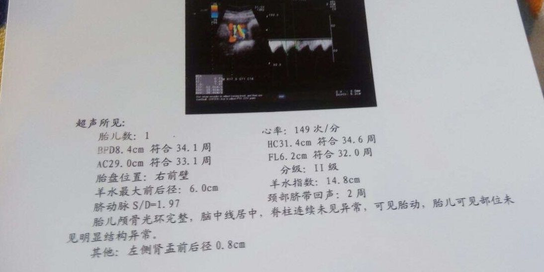 辨别|想知道腹中怀的是儿子是姑娘?教你3招,帮你轻松辨别胎儿性别