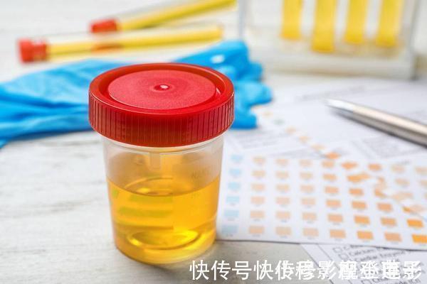 饮水量|肝硬化来临时,通常会有这4种异常,占一个,也要引起注意