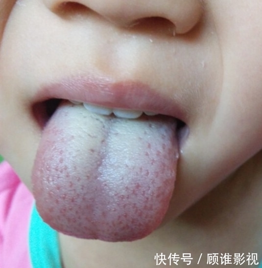 脾胃|儿童脾胃是长高长壮的“核心动力”，调好了高中就长到一米九