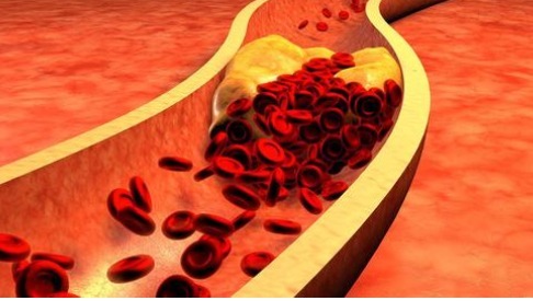 血管|血脂高不高，看头就知道，如果没有4个症状，血管或还很通畅