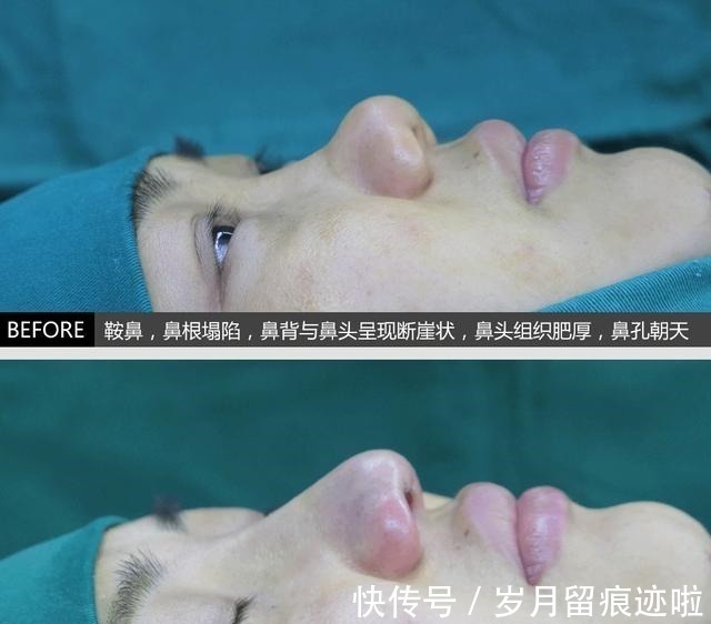 对手术 12种不适合做整形手术的行为,其中4种已被医生列入“黑名单”!