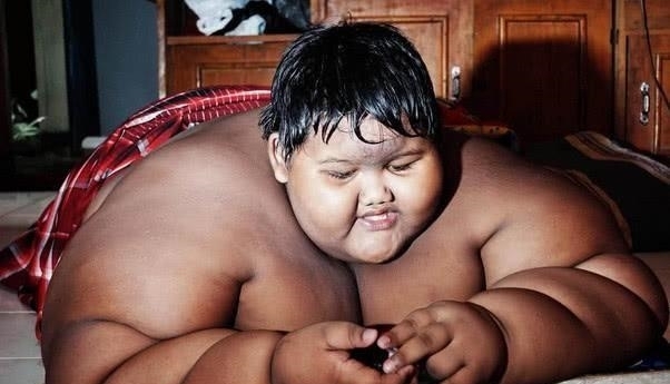 胃旁路手术|10岁男孩“体重”竟重达423榜!两年后逆袭,场面十分惊艳