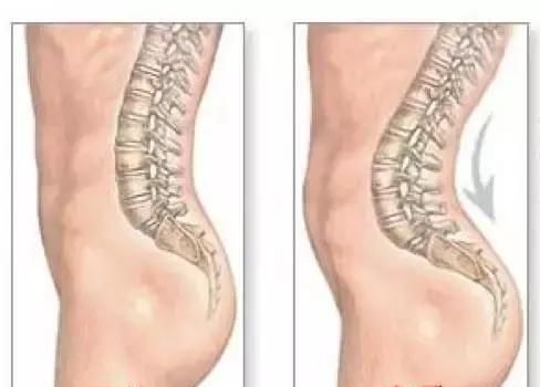 生完孩子后洗个碗都腰疼,是落下月子病了吗?这些护腰知识要关注