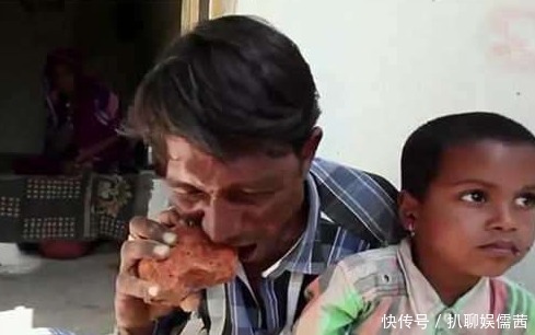 印度一男子不吃饭菜,以砖头为主食,连续吃了20年