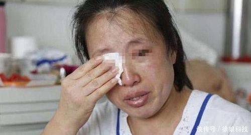 脚趾|4岁孩子脚趾肿的厉害,妈妈不放心带去医院,医生幸好来得早