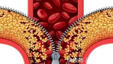 百病|中医直言血管一堵，易生百病，常吃5种蔬菜血管不再堵，别错过