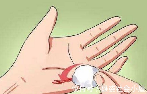 血小板|男性上了50,有“1事”要偷偷做!比运动和饮食都重要,你了解吗