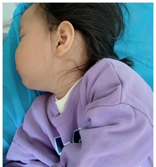 孩子|儿科医生:养脾很简单,2种零食,常给娃吃,积食或绕着走