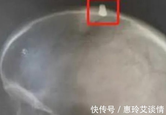 丹尼斯|他脑袋被子弹击中误以为是石头,坚持跑完赛程,还有额外收获