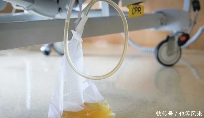 插尿管是怎样的体验？为什么手术之前要插尿管？让医生告诉你真相