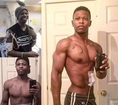 他没有心脏却仍坚持健身,美国27岁小伙感动全球