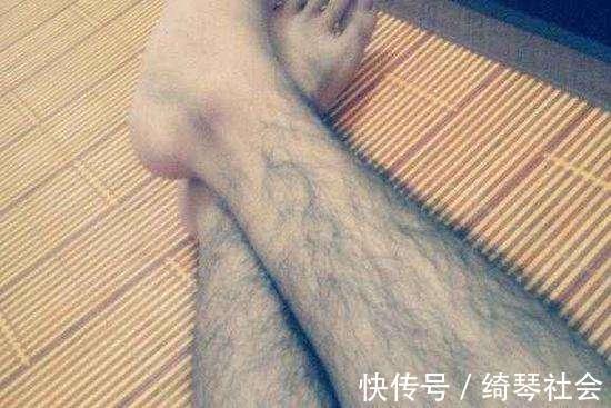 腿毛|腿毛旺盛和腿毛很少的男人，有什么不同专家一次性说清楚
