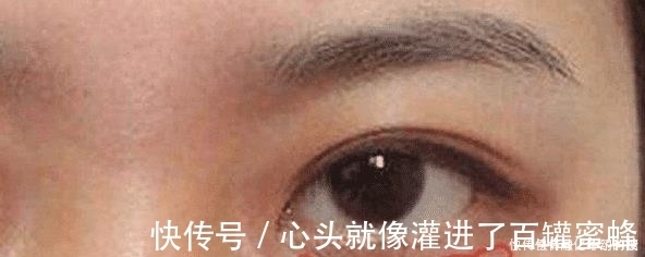 叶黄体生成素|女人患有妇科病,脸部会出现这3个暗号,发现1个就最好去查一查