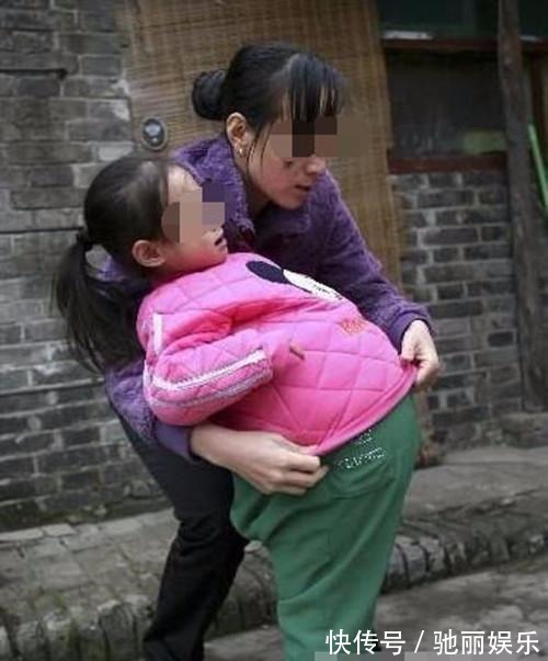 爷爷|4岁女孩肚子1米粗,像怀孕五个月,爷爷却说没事,吃的多胖点好