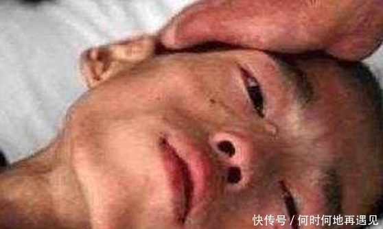 住院|20岁小伙子患癌住院,原因是每天吃这种东西,很多人都吃过
