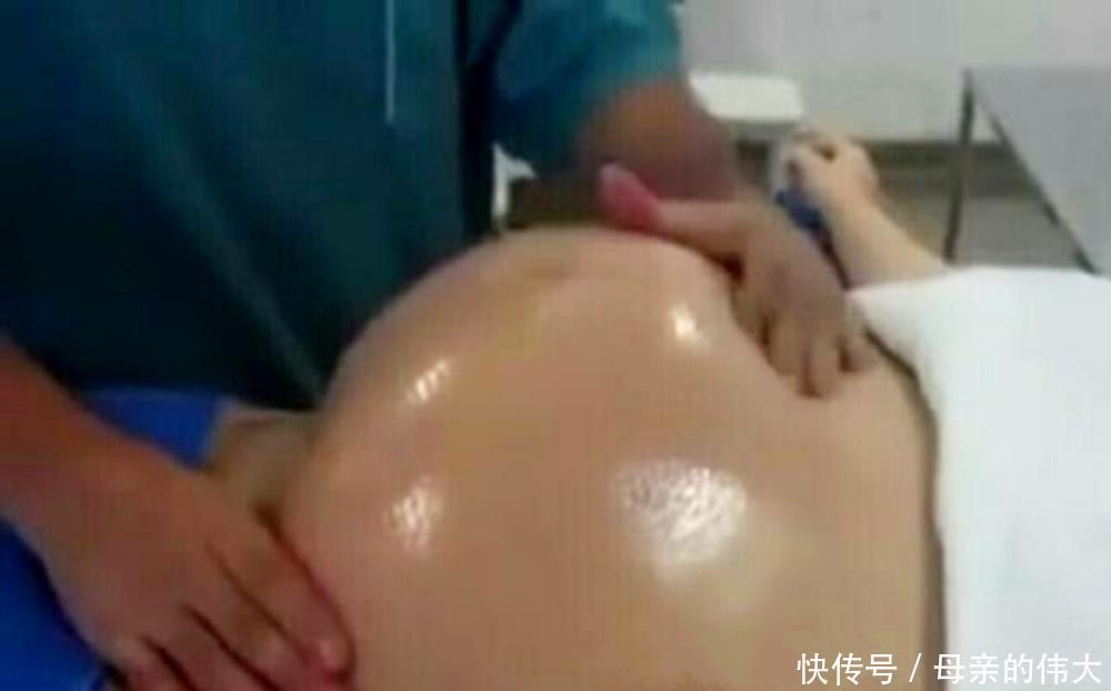 宝宝|怀孕后多久,胎位就要固定了?这个孕周前,孕妈还能“调乾坤”