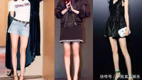 女生|建议“腿粗”女生，分清肌肉腿和水肿腿再坚持这样做，想不瘦都难