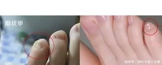 印记|炎黄子孙身上有4大独有印记,看看你是不是纯种的中国人?