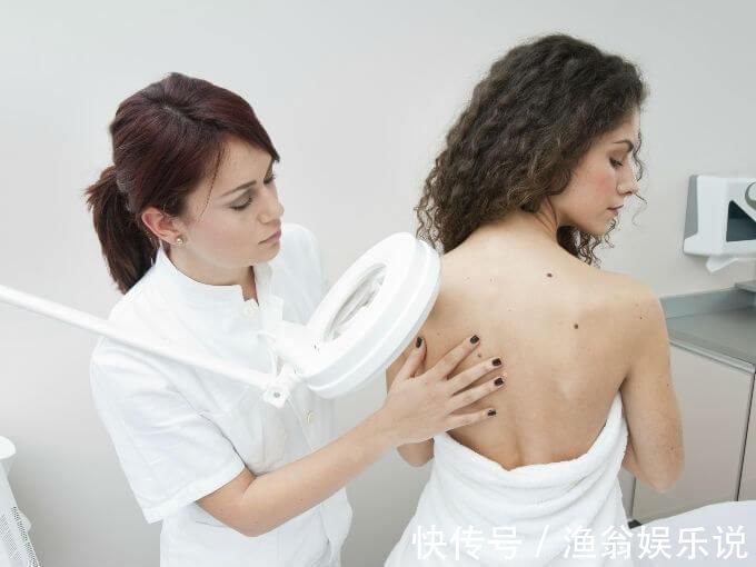 红痣|你的身上长有这种小红痣吗 一定不要大意!