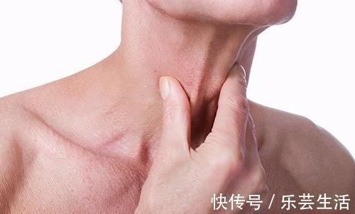 转移癌|发现淋巴结肿大,是肿瘤转移了吗?肿瘤医生教你来判断