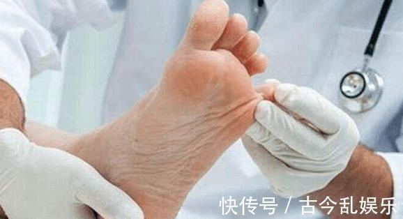 血糖控制|血糖高的人,睡觉时或有以下3种表现,若没有,血糖控制的还不错