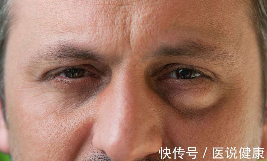 胆汁|肝功能受损时,身体会频繁出现3个症状,发现后,需及时检查