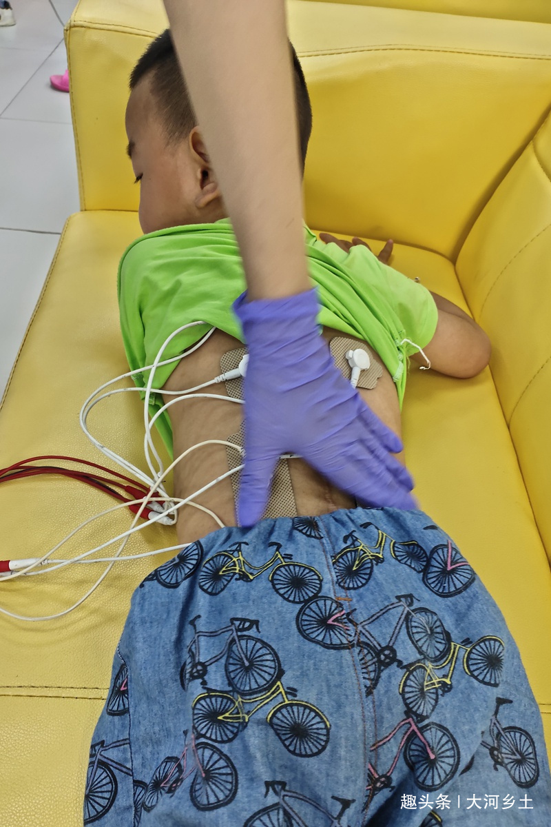 白云山|儿子患癫痫治疗花了近40万仍无法行走,母亲放弃自己的治疗救子