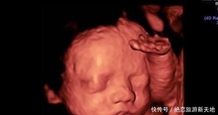 孕期做四维有什么好处,什么时候做最好这个时候做是最好的