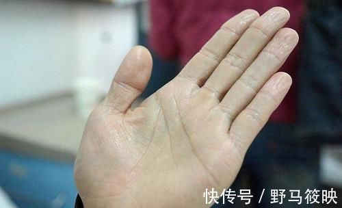 中医|脾虚不能随便补,对症健脾效果好!脾怕的5件事,大家别再做了