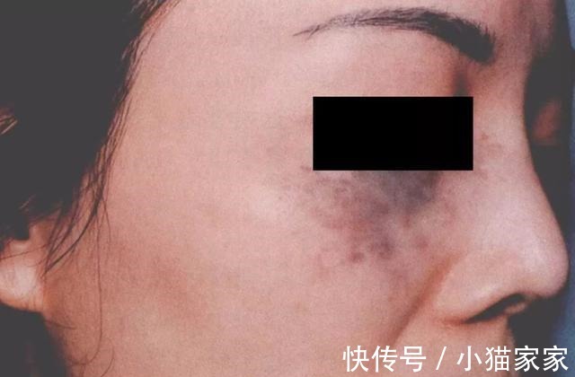 护肤品 哪些皮肤问题是护肤品不能解决的!