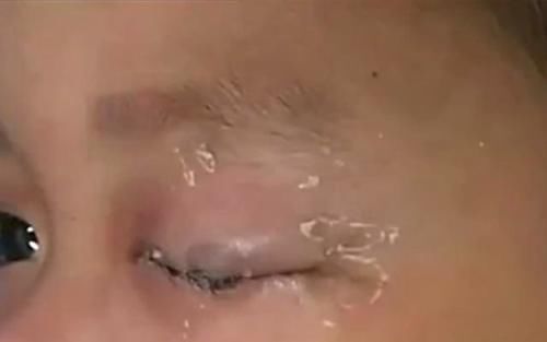 睿智|4岁儿子误将502滴进眼睛,妈妈一个举动挽救孩子,医生:睿智
