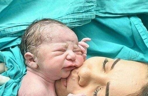 脐带|刚剖腹出来的宝宝伸手抓住医生的剪刀,不让剪断脐带!