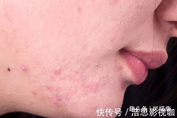 女性|子宫干净的女性,脸上不会出现3种症状,若占一种,别忽视