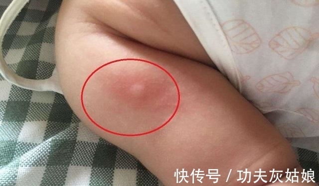 招蚊体质|蚊子的危害可致命!家有“招蚊宝宝”,试试这些驱蚊方法,很有效