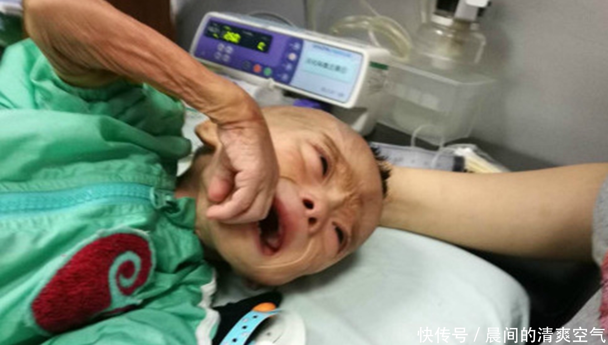 6岁男童积食不长个，医生看舌苔后捂鼻问：“防腐剂”吃了多少