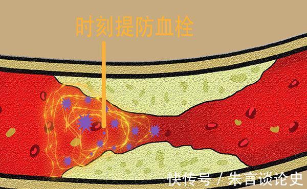 肌肉痉挛|睡觉时突然腿抽筋,就是缺钙?错!还有这几个原因,也不要忽视