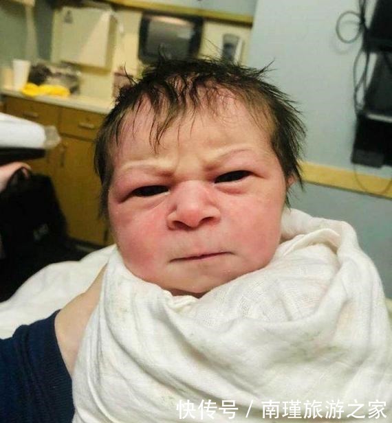 外国|外国女子切除部分子宫后仍怀孕,剖腹产诞下“生气宝宝”