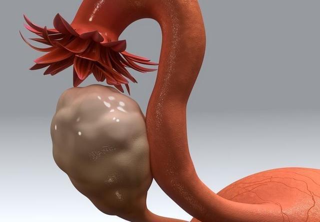 提高免疫力|32岁女子查出宫颈癌,自称没有任何疼痛感,但是2个指标要重视