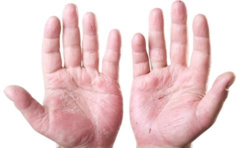 穴位|湿气重,吃不下,睡不香,老中医敲打我这些地方,居然好多了