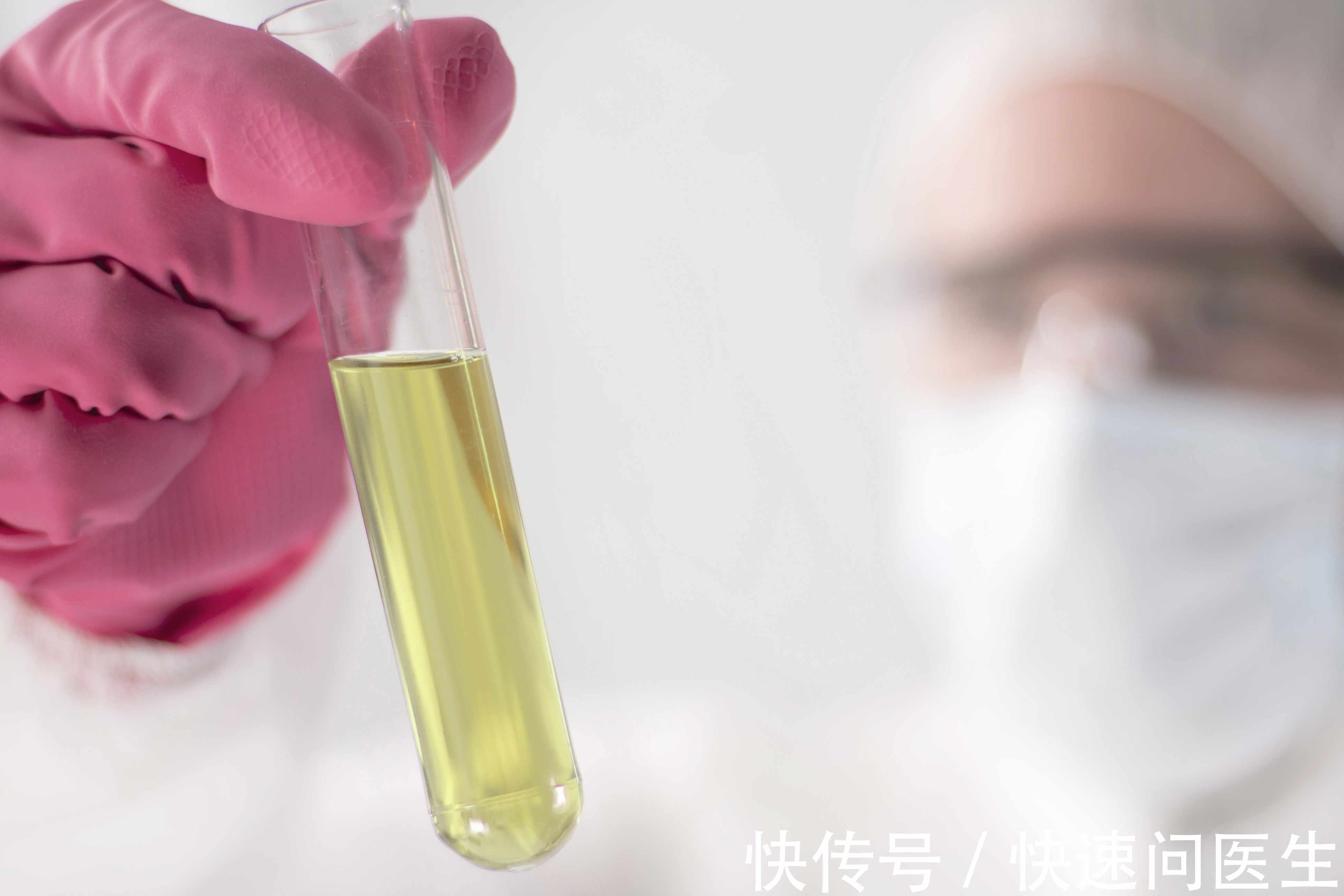 小便|糖尿病只是夜尿增多而已?糖尿病不用治疗?一文解析