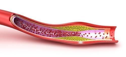 血常规|血常规可以看出是否患有癌细胞吗?听医生怎么说,不妨了解一下