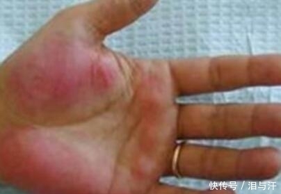  暗示|身上这个部位不会喊疼，一旦出问题就是癌，6个早期暗示别错过了