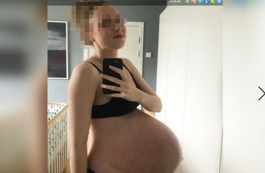 孕妇|孕妈因“悬垂肚”走红,人人都说是双胞胎,宝妈的讲述让人心疼