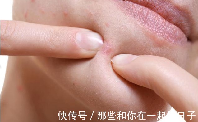 厨房|万病之源是寒湿,一个驱寒祛湿的小茶方,材料就在厨房里