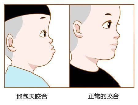黄金期|孩子牙齿矫正,必须要12岁以后吗?你是否错过了孩子的矫正黄金期