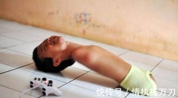 伊利斯|2岁女童看起来像80岁,病情独特全球首例,网友:希望返老还童