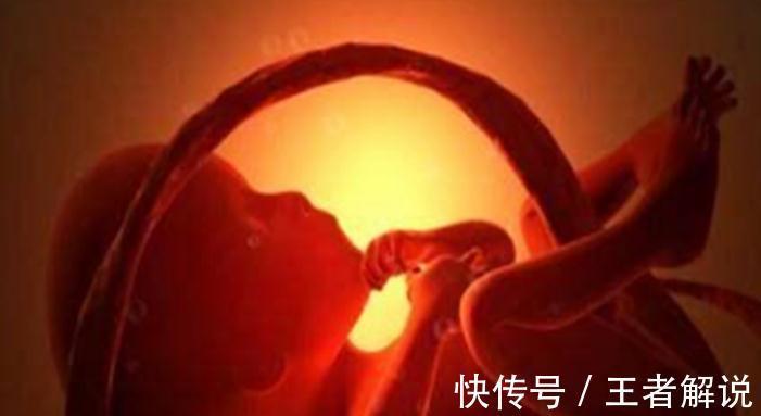 脐带|一听到脐带绕颈四个字,孕妈们就如临大敌,其实起因十分正常