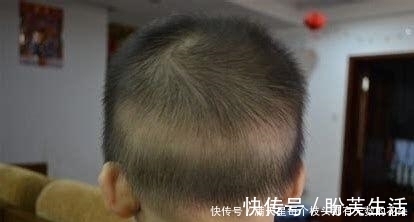 补钙|怎么知道宝宝缺钙?宝宝缺钙会有这些表现,宝妈发现了吗?