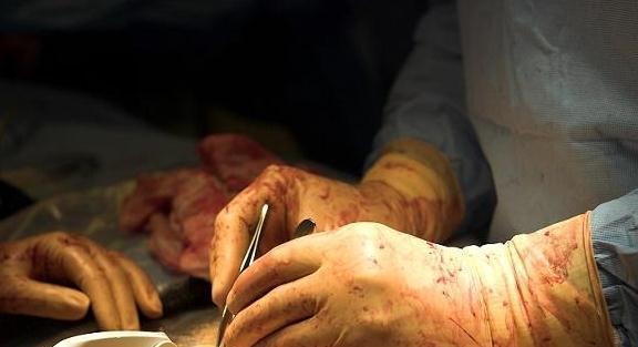 顺产|剖腹产和顺产的孩子,最大的差别不是智力,原来是这方面,懂了